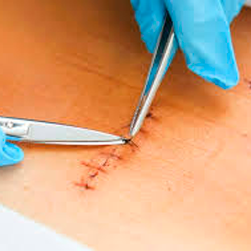 servicio curaciones a domicilio, curaciones a domicilio