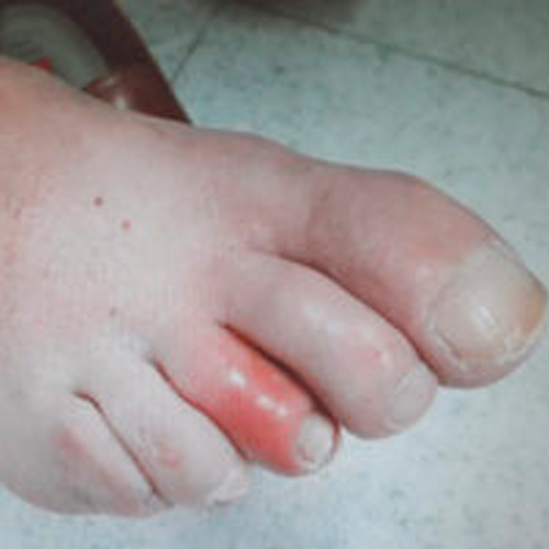 servicio curaciones a domicilio, curaciones a domicilio